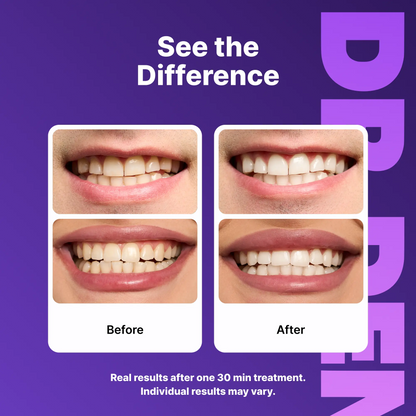 Purple Smile Brightening Strips